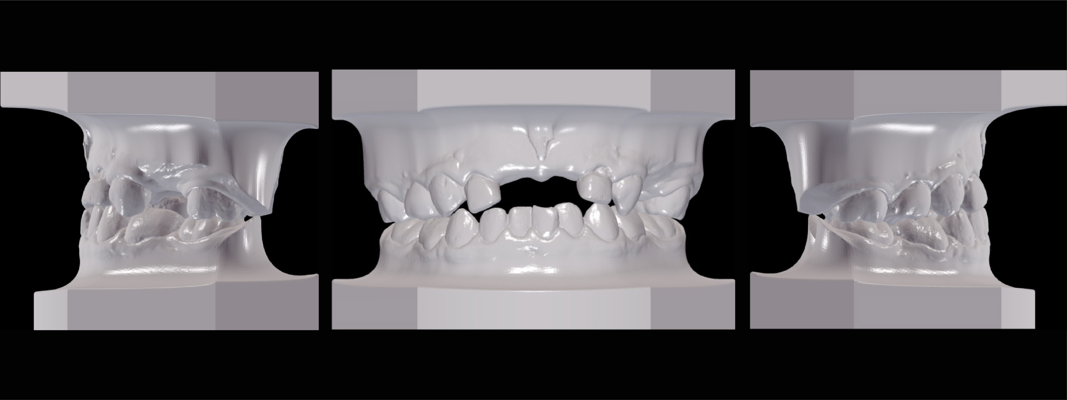 Radiografía Intrabucal